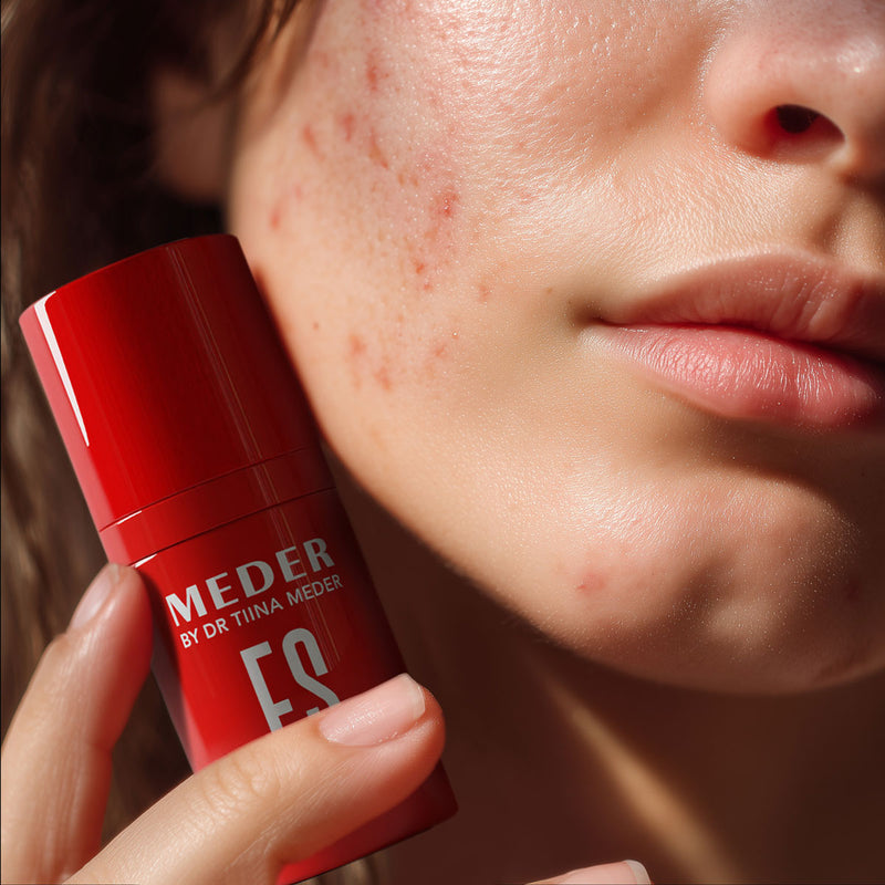 Meder Eu-Seb Anti-Acne Active Serum